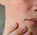 Tips for Relieving Dry Skin